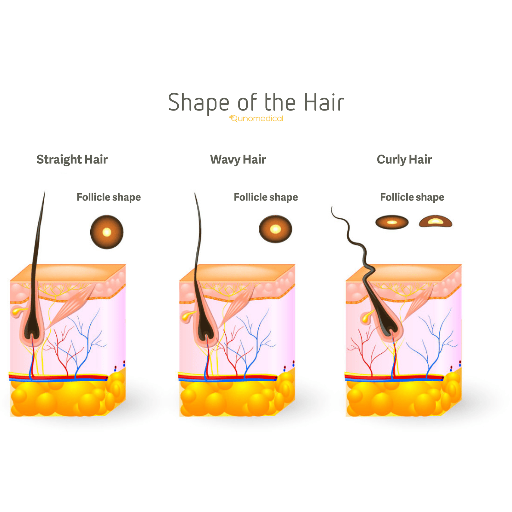 Illustration showing the different shapes of hair.
