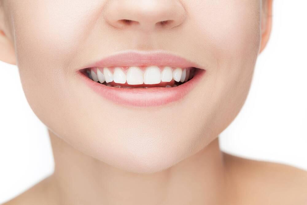 blog_veneers-before-after_image