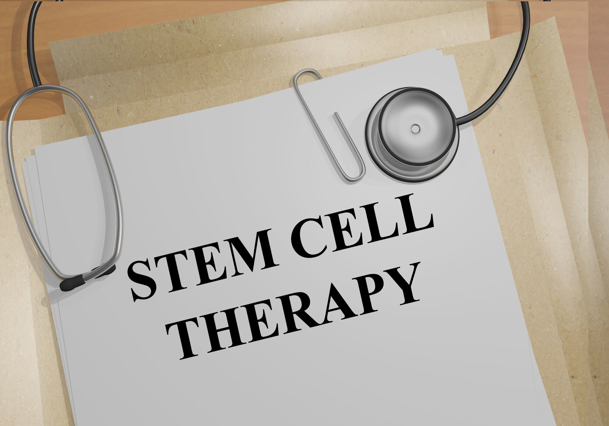 Terapia con cellule staminali prima di un trapianto di capelli