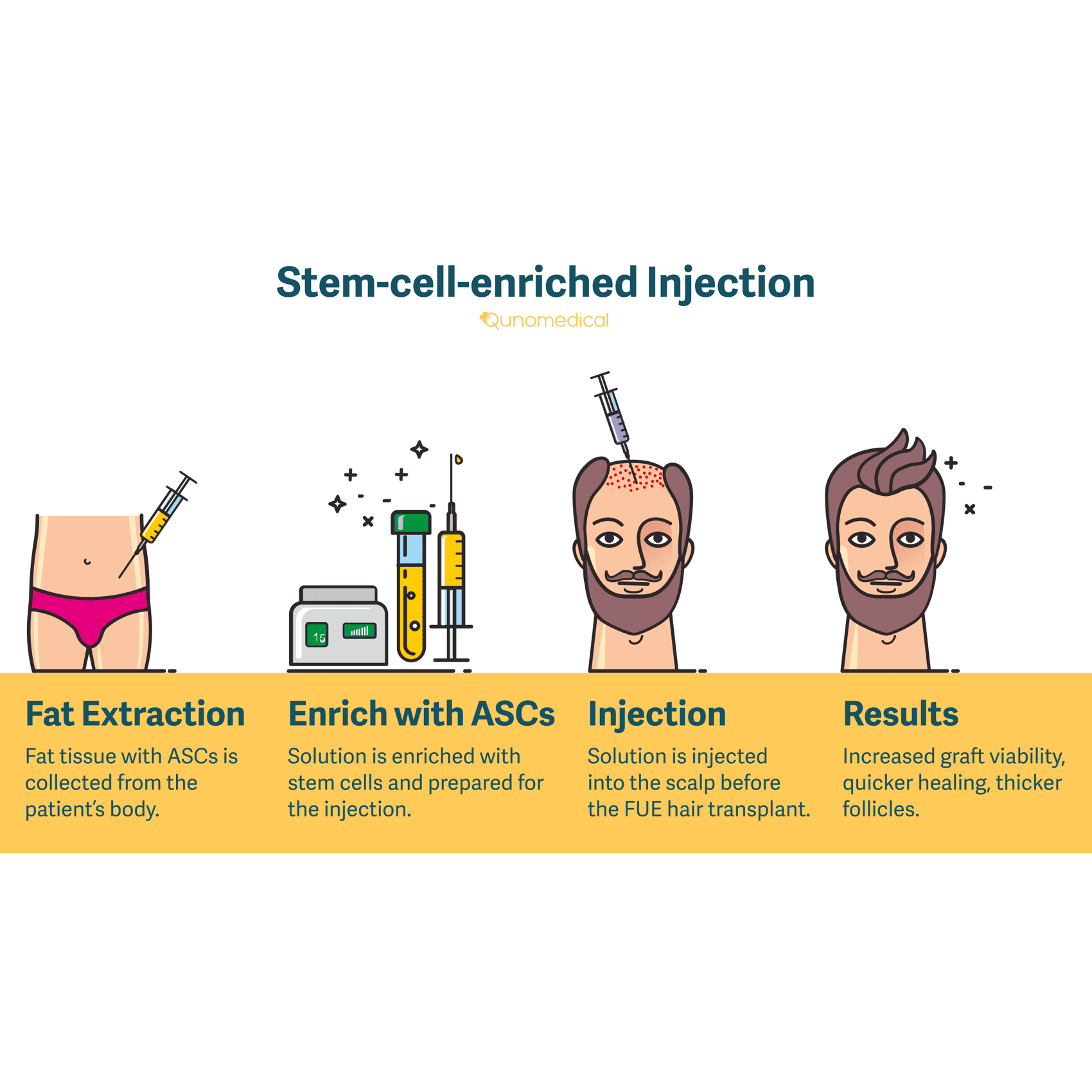 stemcellenrichedInjection_Image