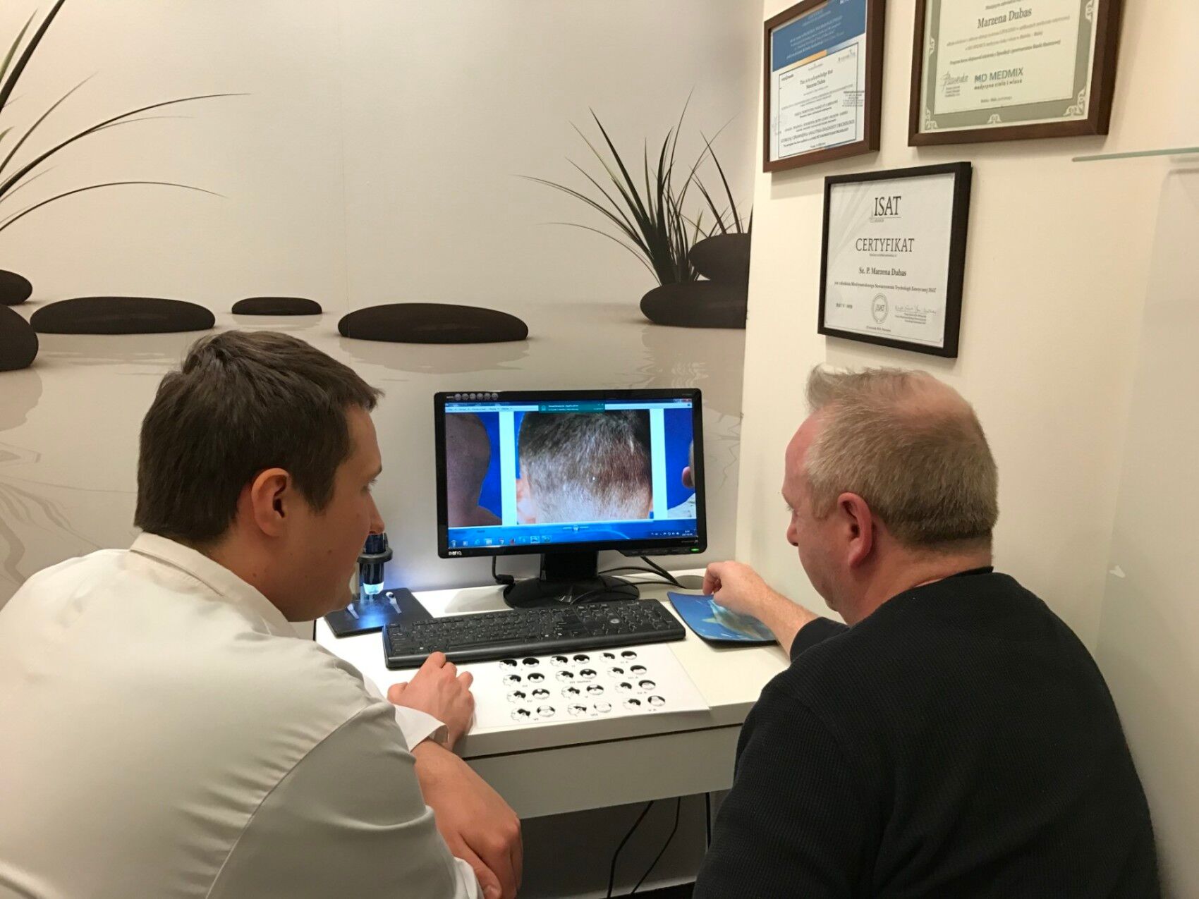 Image2_Eamon’s Hair Transplant Journey - Part II: During Treatment