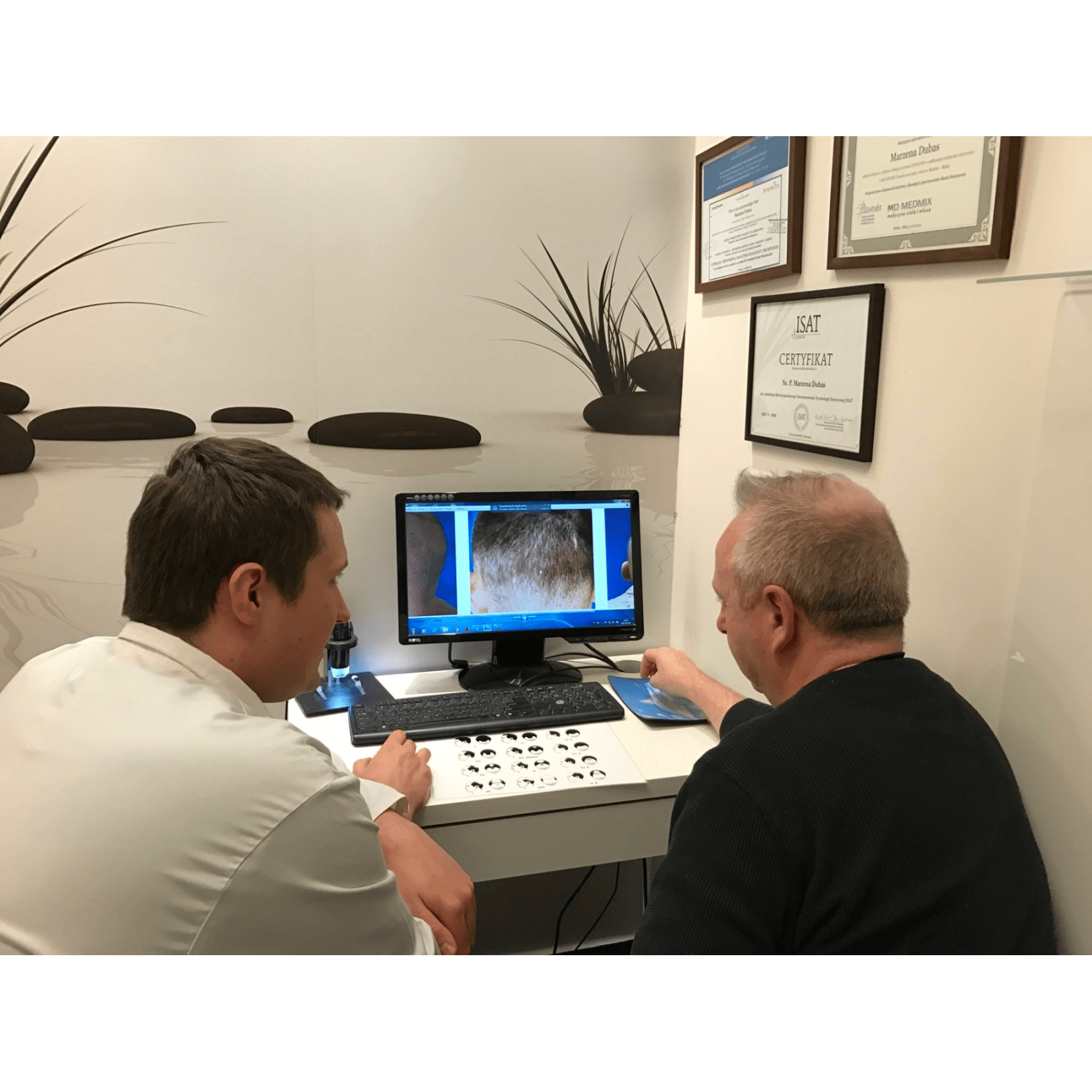Image2_Eamon’s Hair Transplant Journey - Part II: During Treatment