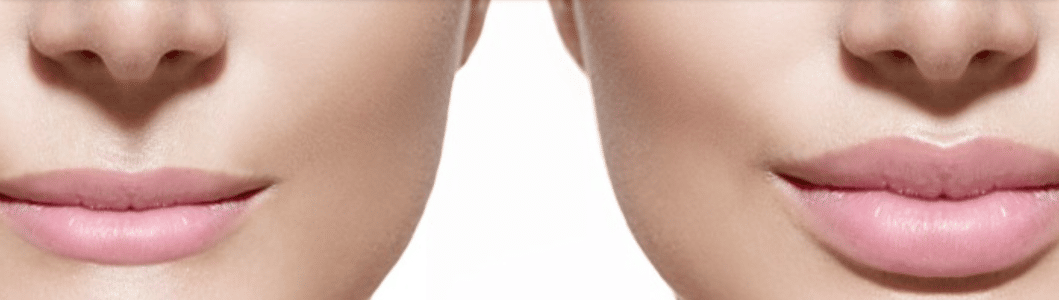 Image_most-popular-cosmetic-surgery