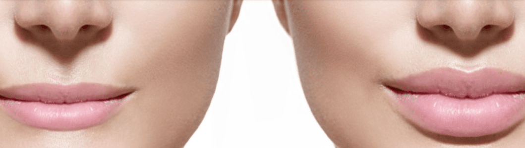 Image_most-popular-cosmetic-surgery