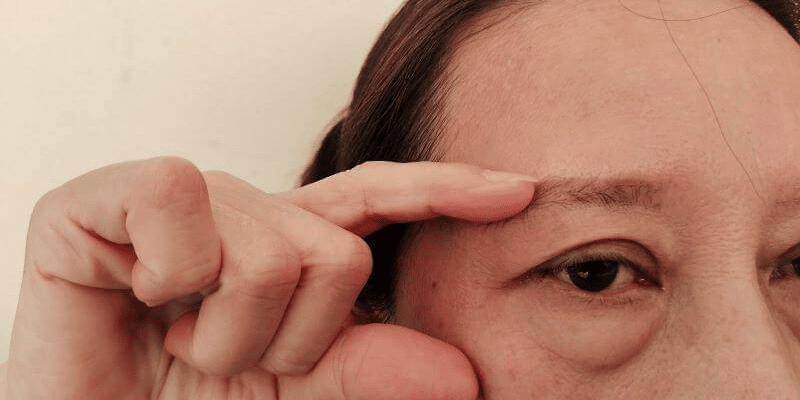 Lady displays her hooded eye