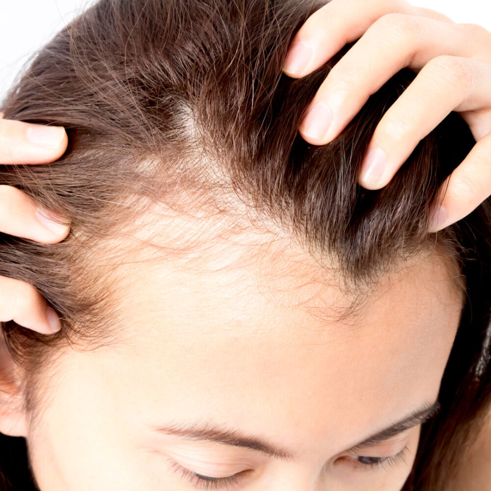 Image3_ImageText_Female Hair Transplants: All You Need To Know