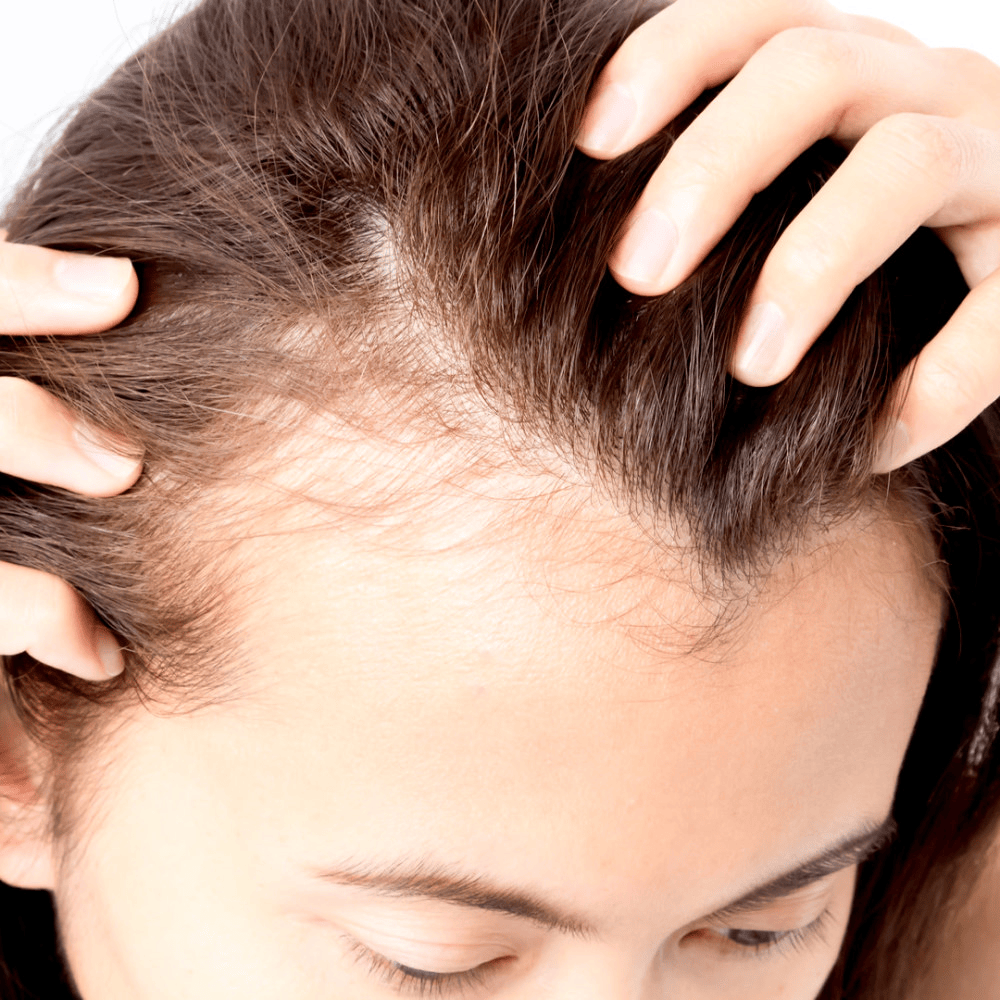 Image3_ImageText_Female Hair Transplants: All You Need To Know