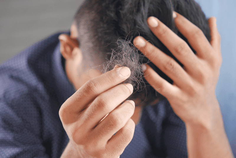 Mann hält sein eigenes Haarbüschel in der Hand