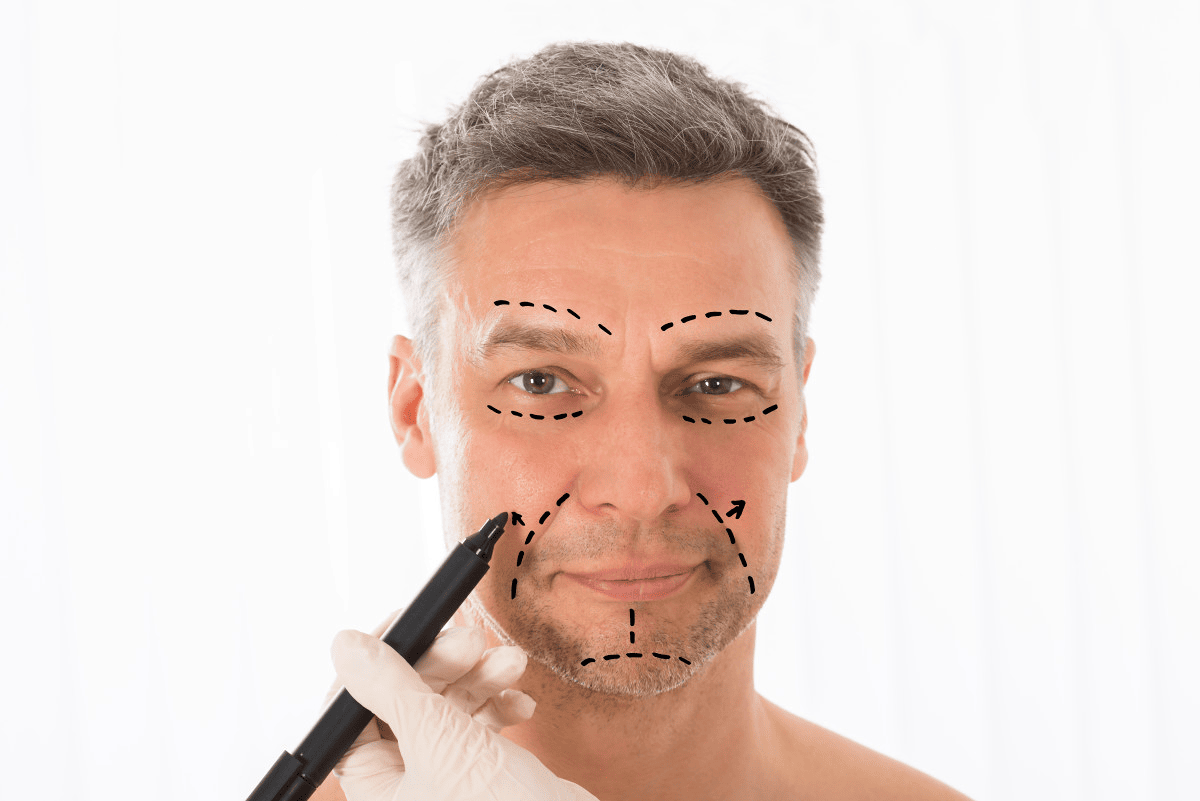 EN image 3 for Facelift Cost Guide