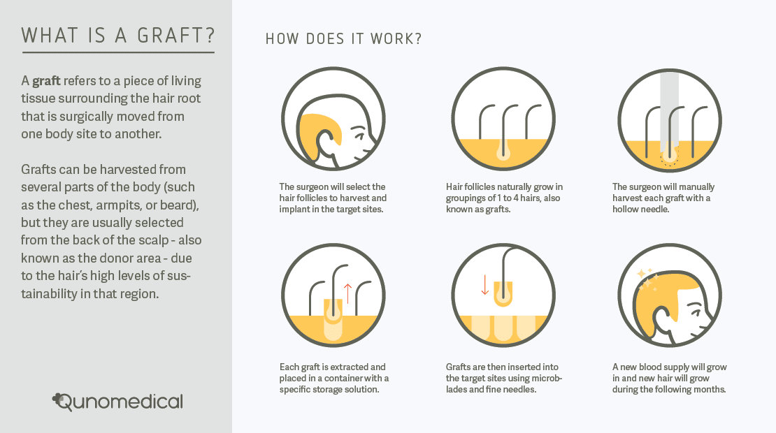 tp-gallery-graft