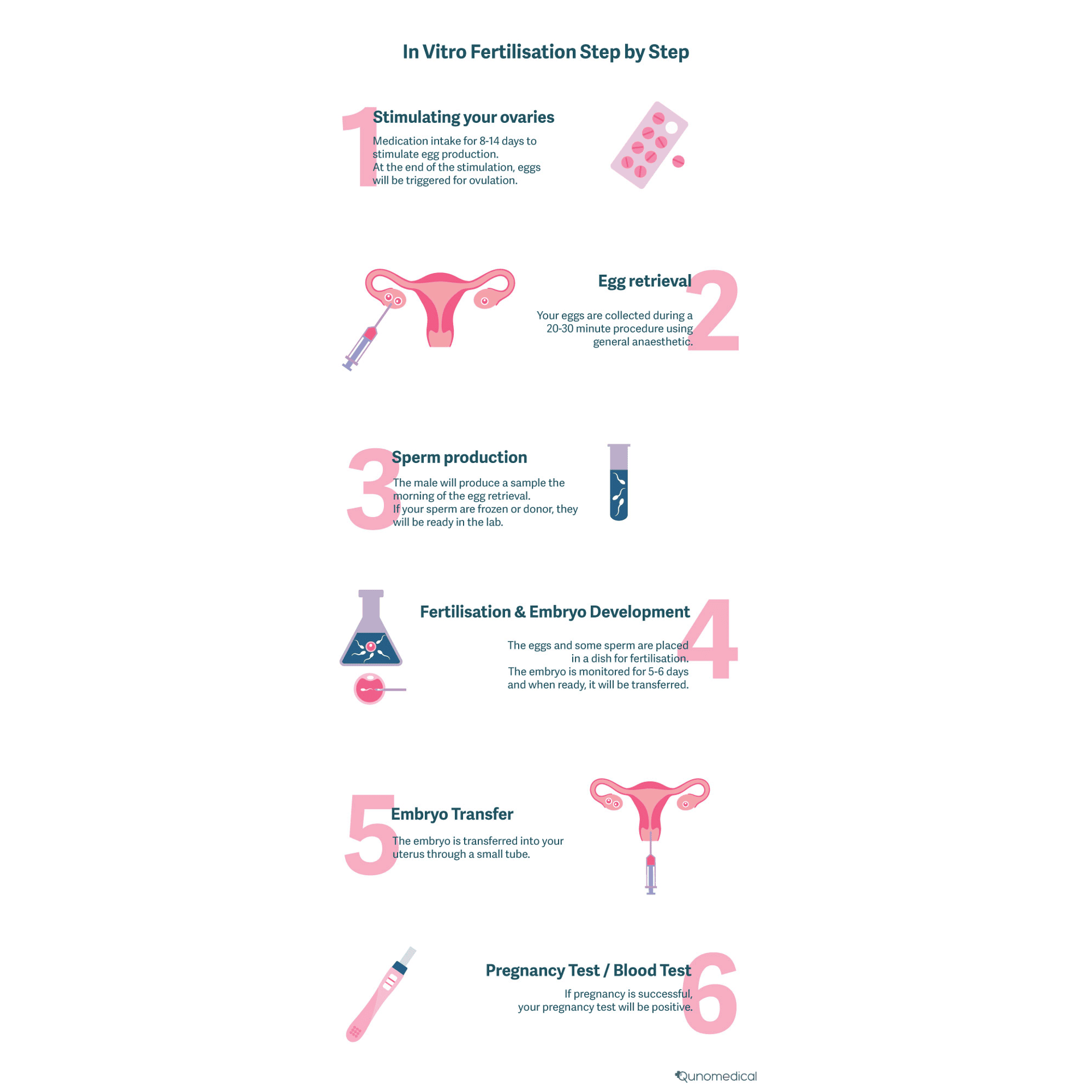 In-vitro-fertilisation-step-by-step-infographic