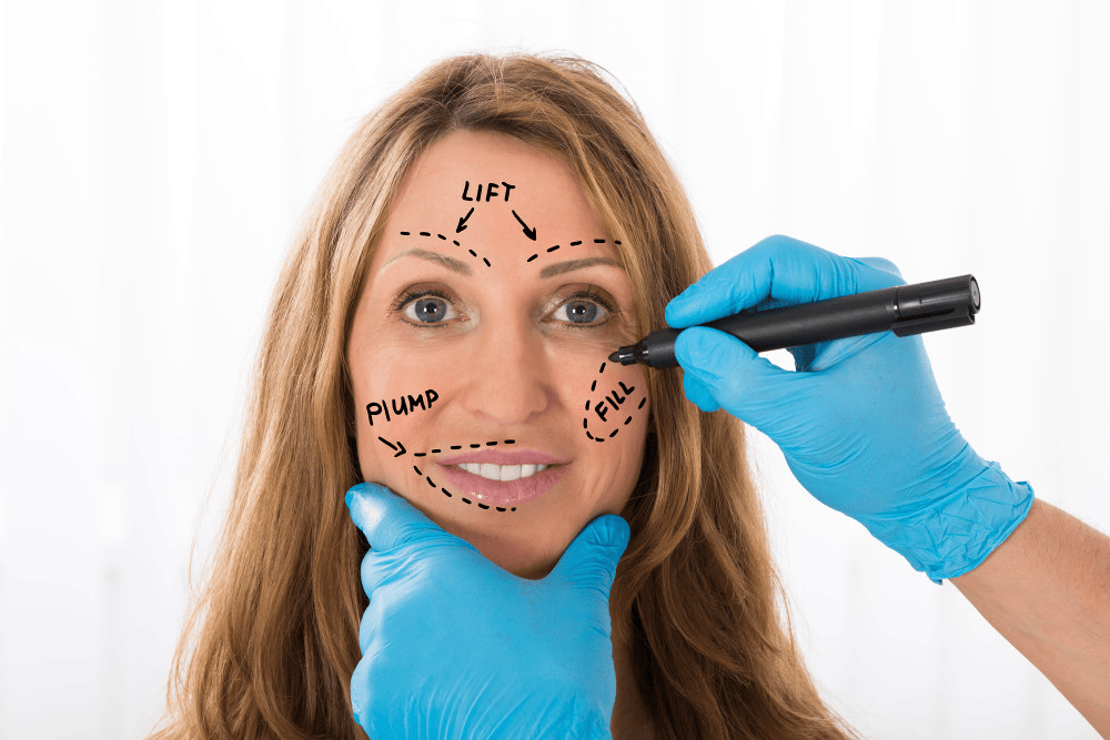 EN image 2 for Facelift Cost Guide