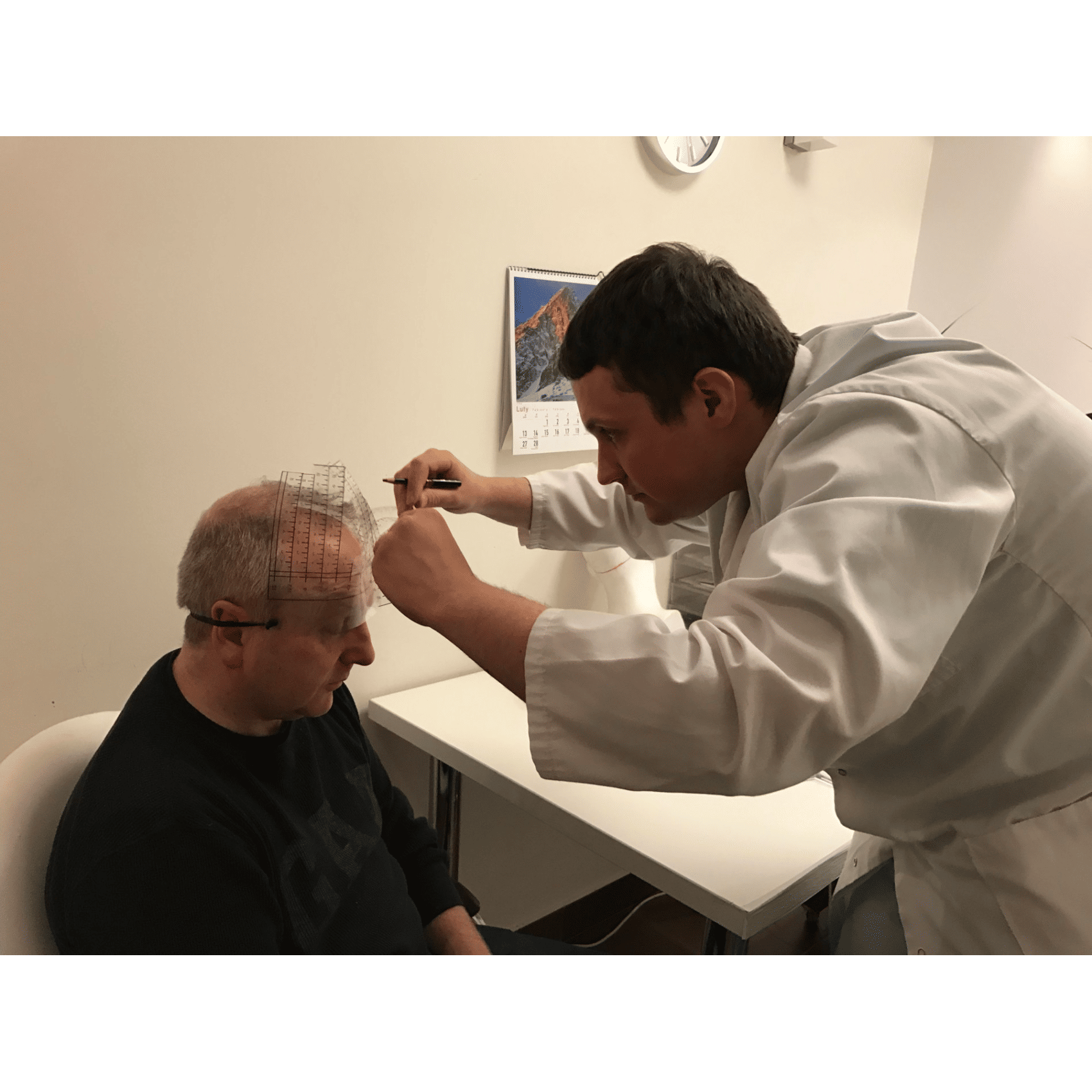 BannerImage_Eamon’s Hair Transplant Journey - Part III: After Treatment