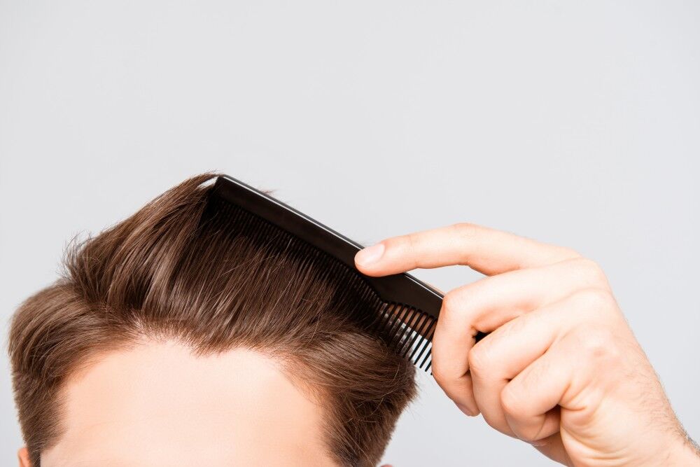 Image2_7 Questions Answered to Get You Ready for Hair Transplant Surgery Abroad