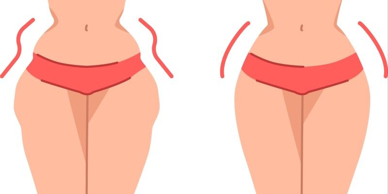 Woman with and without hip dips