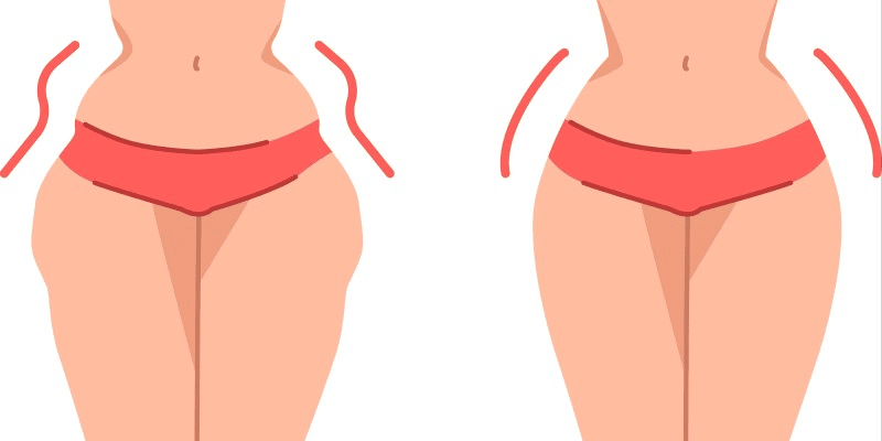 Woman with and without hip dips