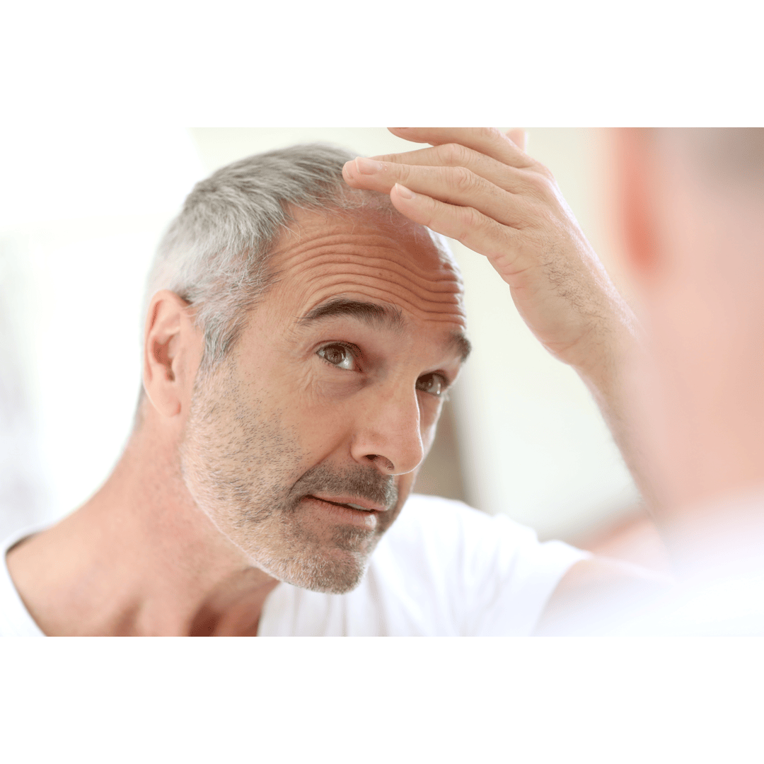 Homme chauve et d'âge mur regardant sa ligne de cheveux dans le miroir