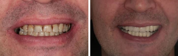 Image5_How a Trip To Croatia Made One Of Our U.S. Patients Smile Again