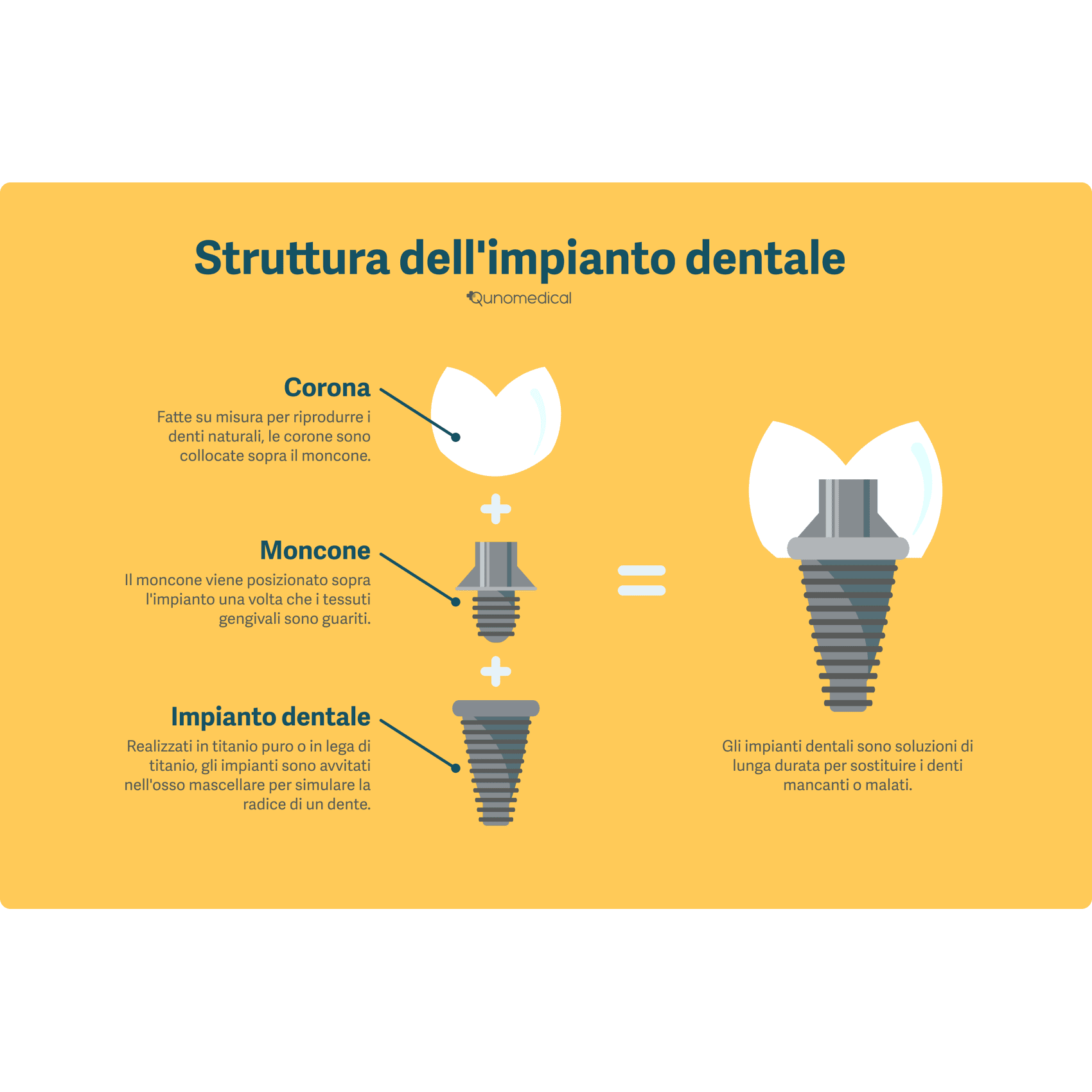 Diagramma che mostra la struttura di un impianto dentale.