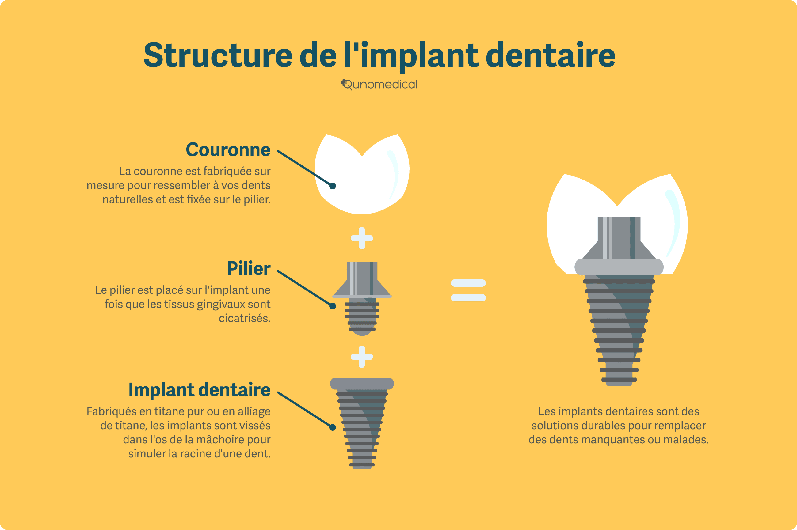Structure d'un implant dentaire.