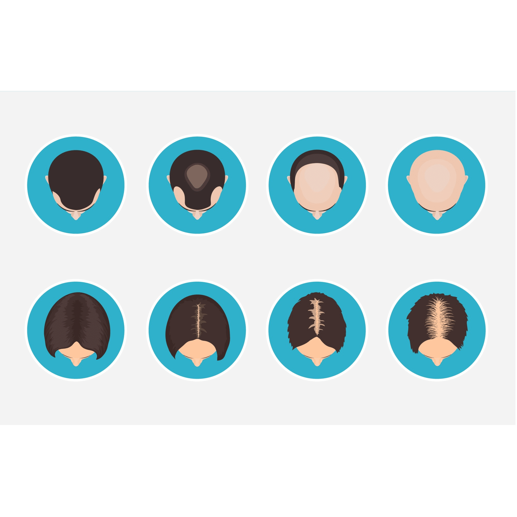 female-male-hair-loss