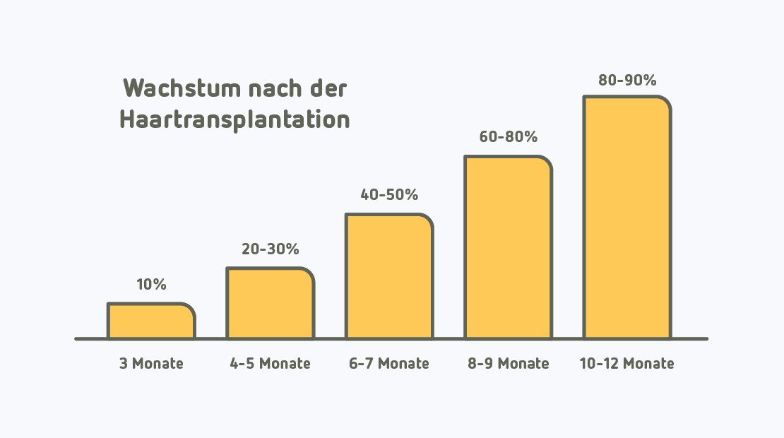 Grafik zeigt, wie lange das Haarwachstum nach einer Haartransplantation dauert.