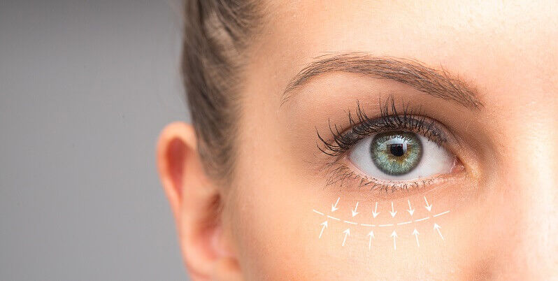 Blog: Eye Bags - Banner