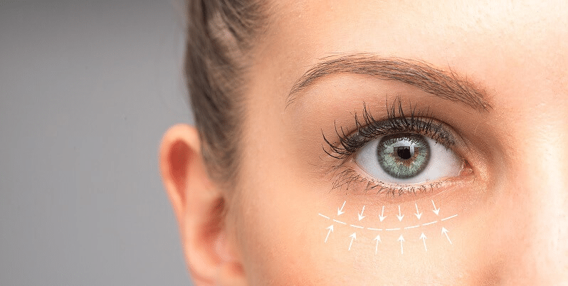 Blog: Eye Bags - Banner