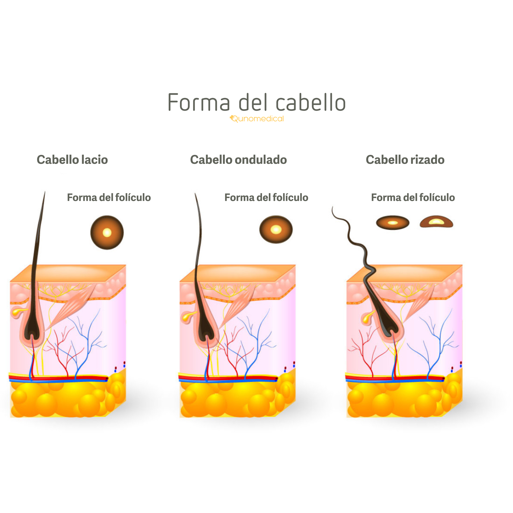 Ilustración que muestra las diferentes formas del cabello.