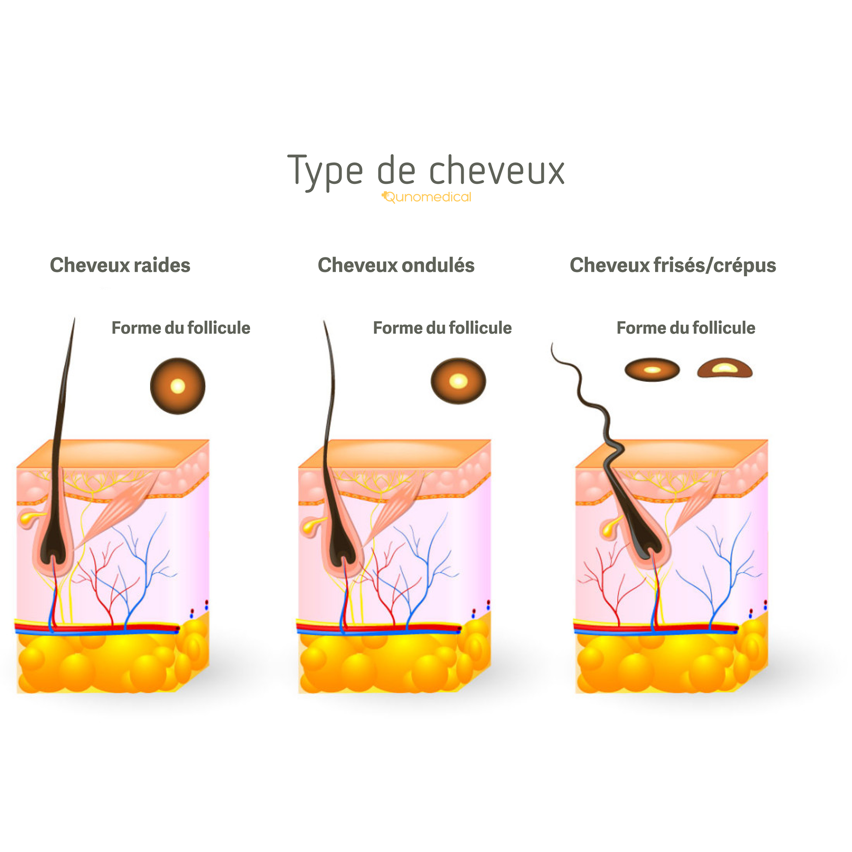 Illustration montrant les différentes formes de cheveux.