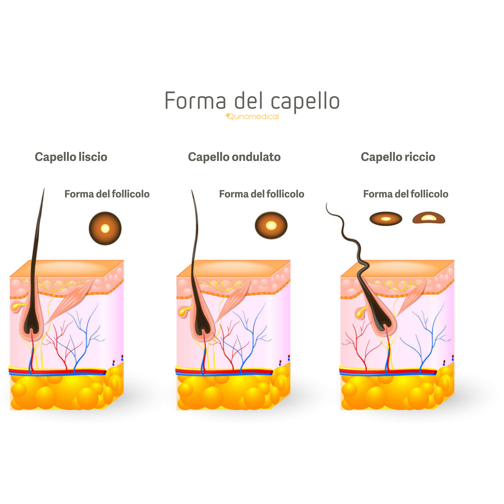 Illustrazione che mostra le diverse forme di capelli.