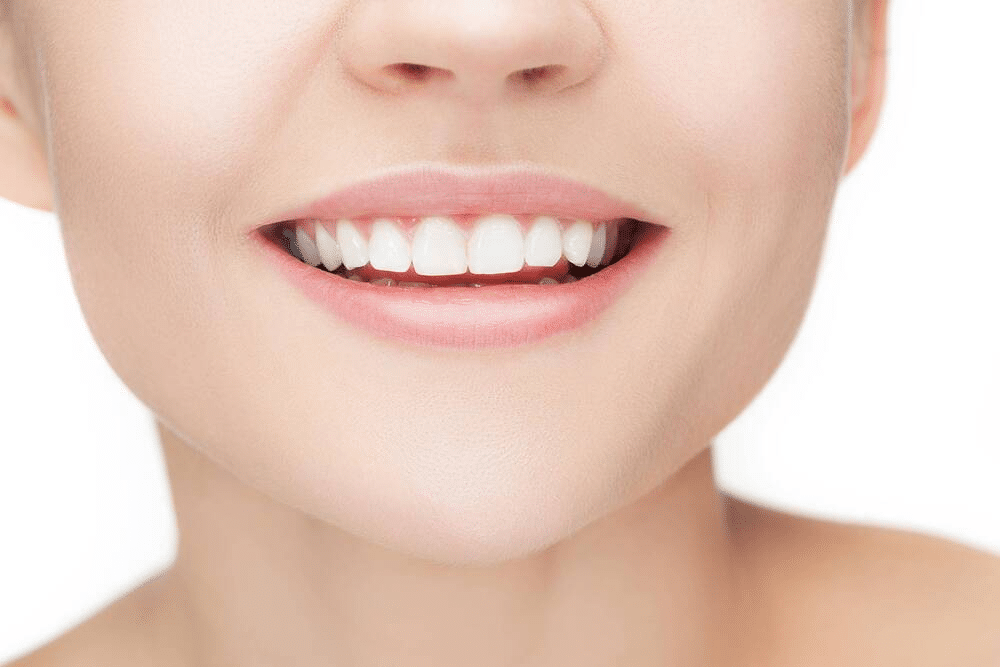 blog_veneers-before-after_image