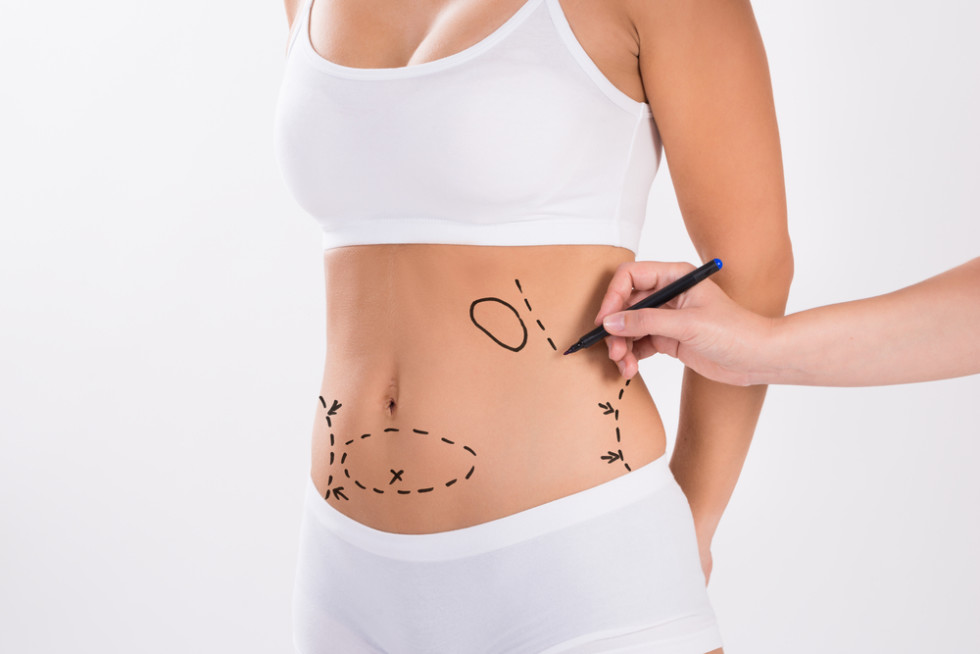  Liposuction Cost Guide, Abdominoplasty Cost Guide
