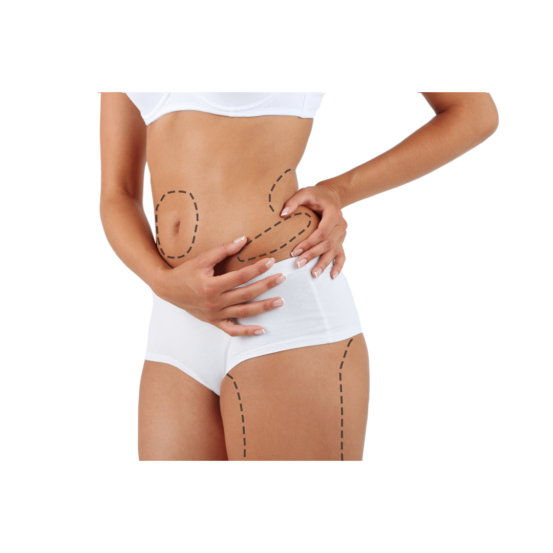 Liposuction Cost Guide, Abdominoplasty Cost Guide