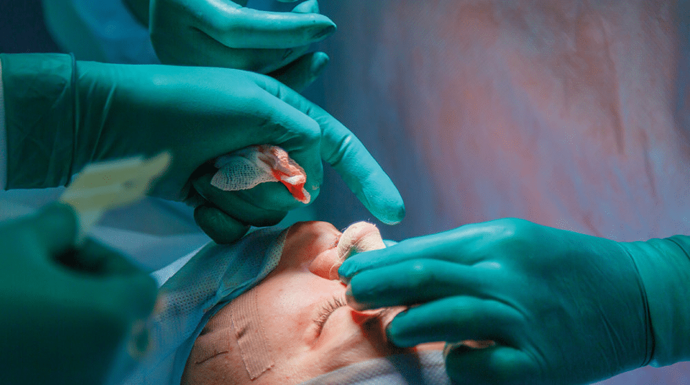 Doctors performing rhinoplasty surgery on a patient.