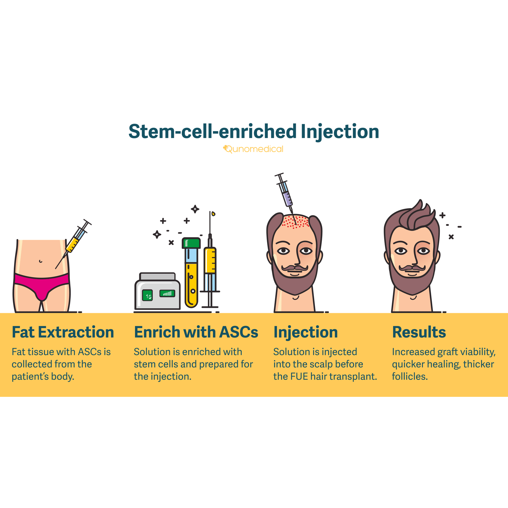 stemcellenrichedInjection_Image