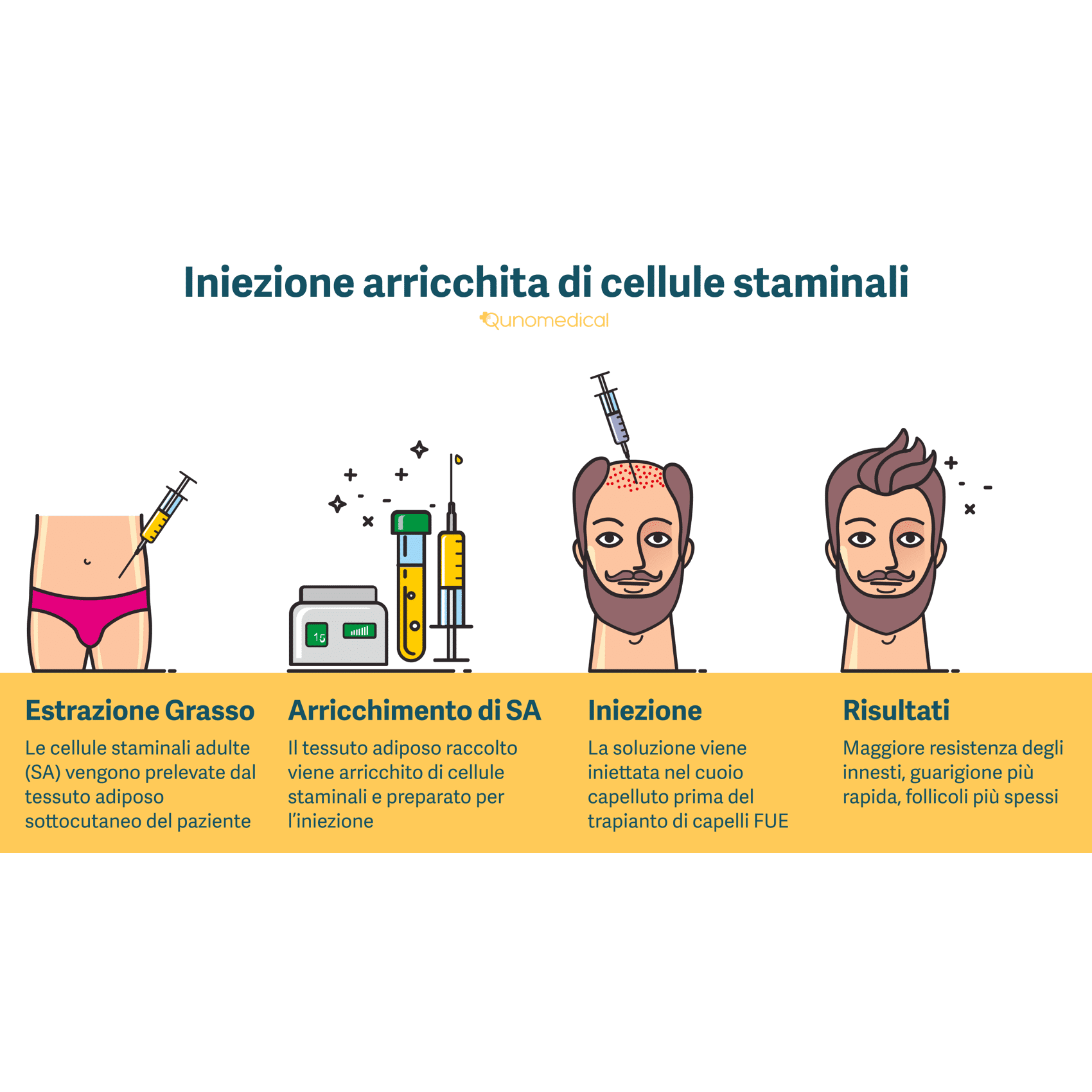 Iniezione arricchita di cellule staminali_image