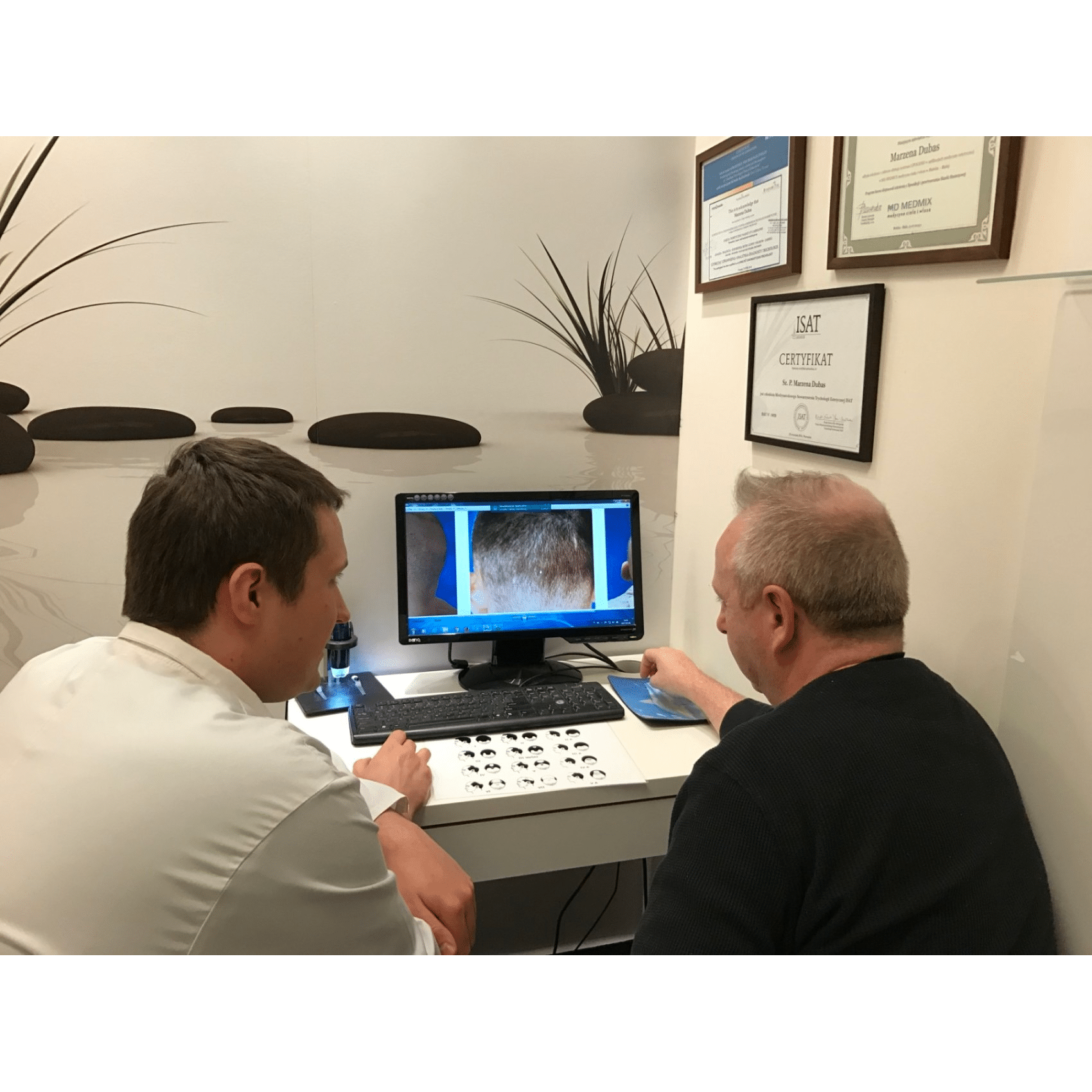 Image2_Eamon’s Hair Transplant Journey - Part II: During Treatment
