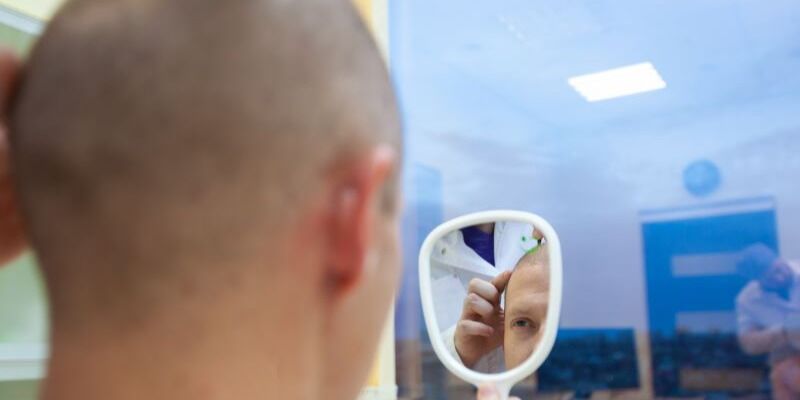 Make an informed choice by discovering the best countries for a hair transplant.