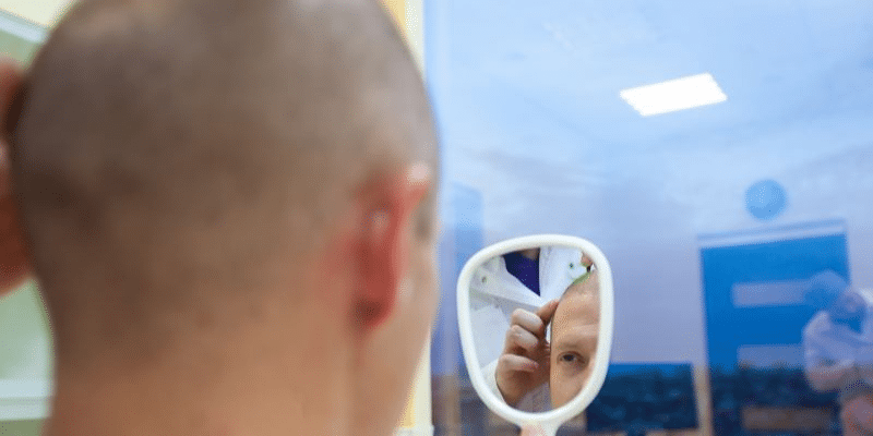 Treffen Sie die richtige Entscheidung und informieren Sie sich über die besten Länder für eine Haartransplantation.