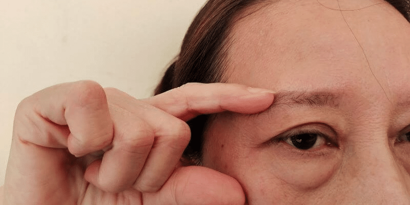 Lady displays her hooded eye