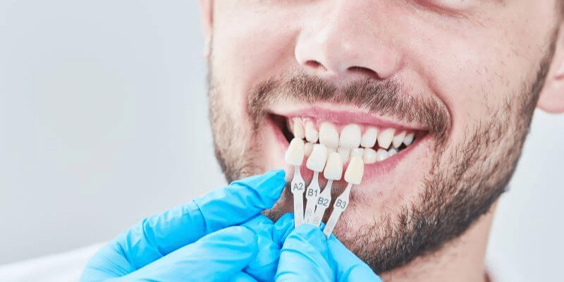 A dentist examines a patient's teeth so that custom veneers can be made.