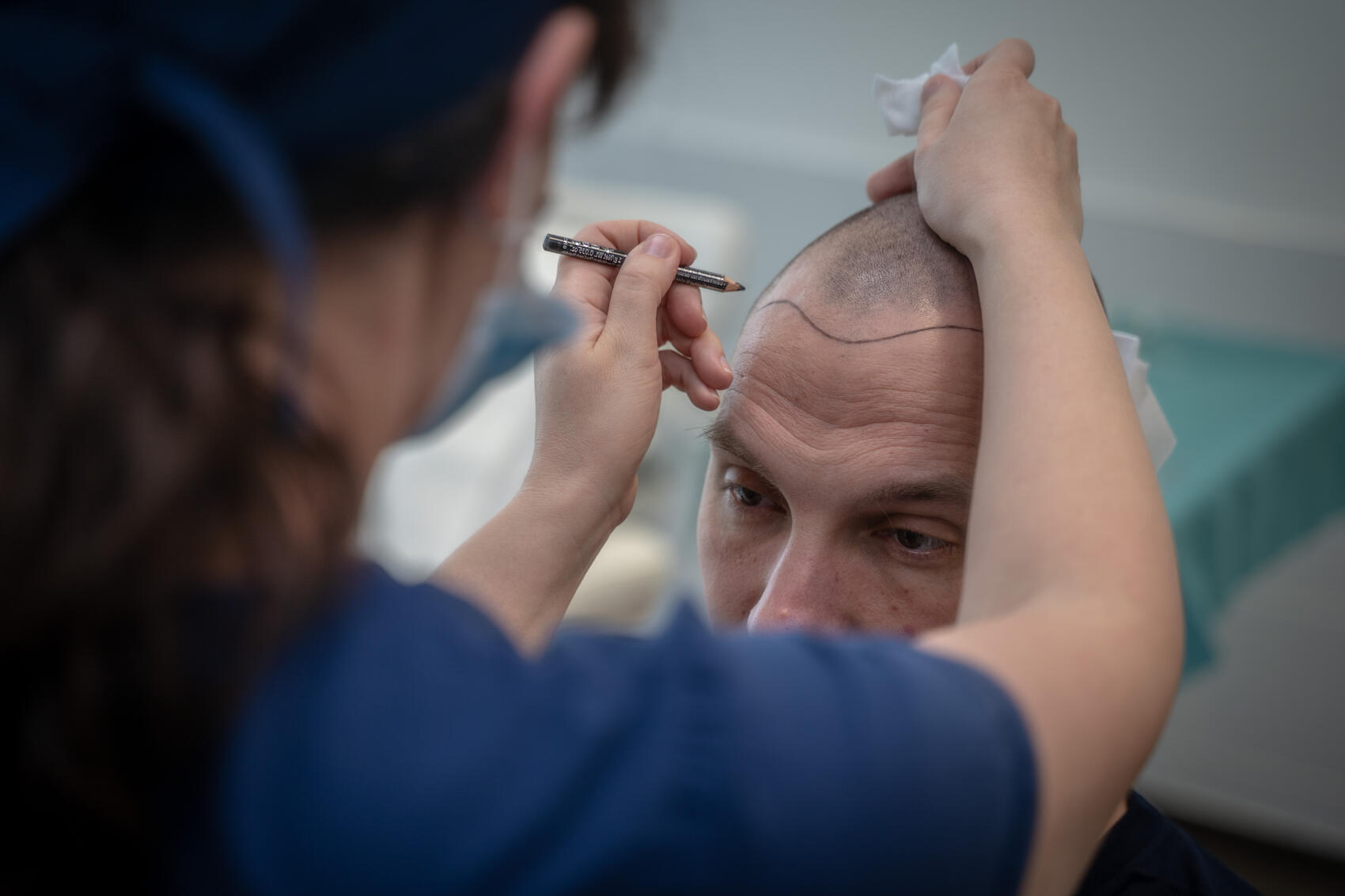 Hair Palace Pre-op Consultations