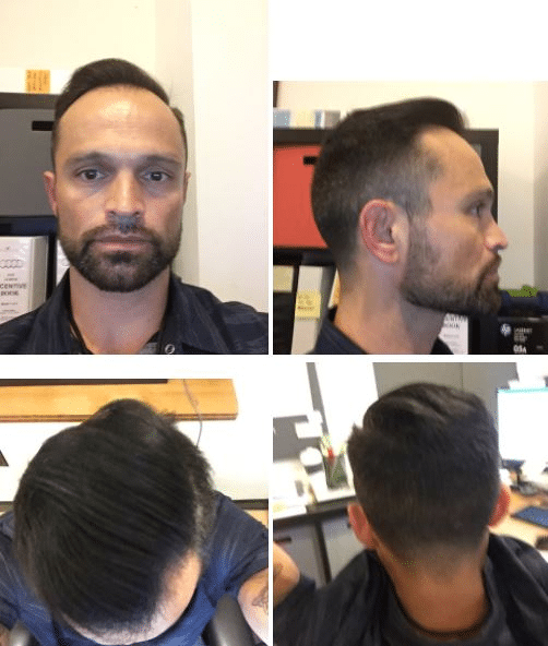Blogpost_Image_fred before after