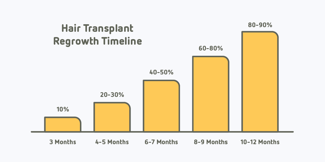 Hair transplant regrowth timeline illustration
