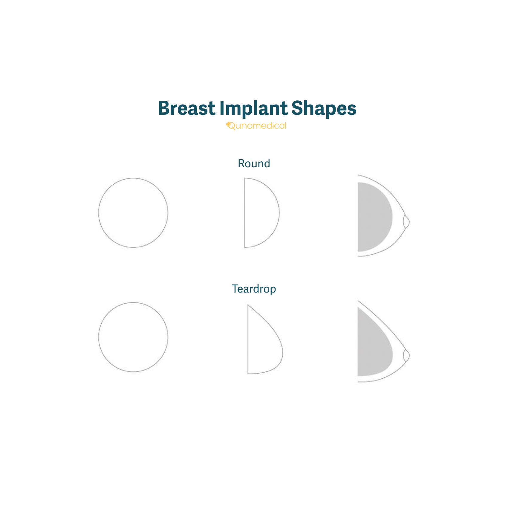 The different shapes of breast implants.