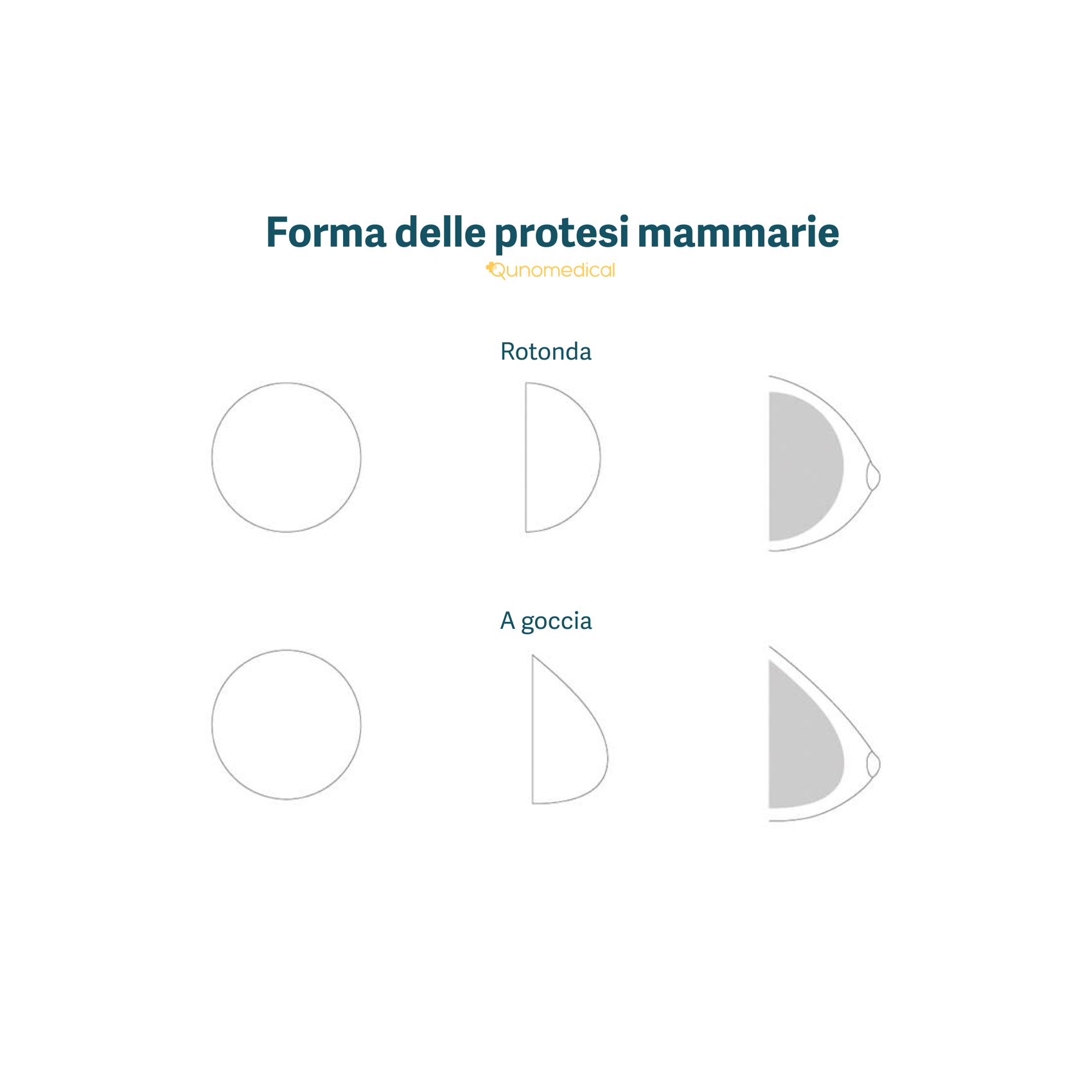 Le diverse forme di protesi mammarie.