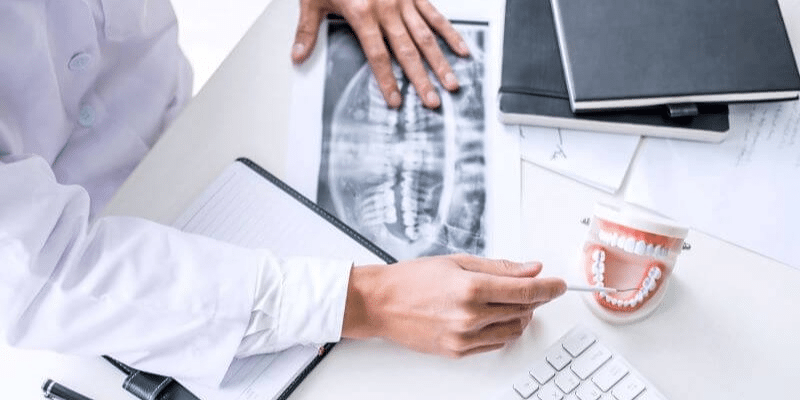 A dentist explains the differences between crowns and veneers.