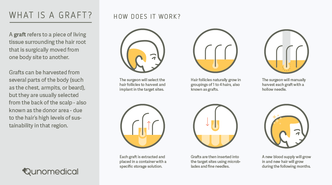 tp-gallery-graft