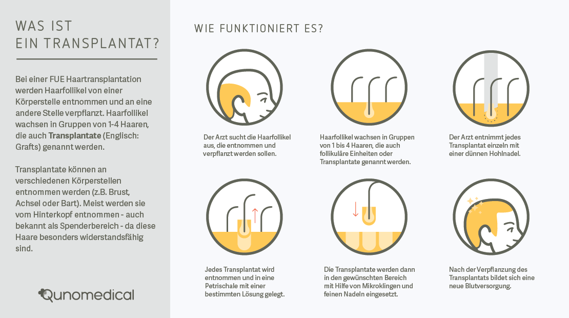 Was%20ist%20ein%20Transplantat